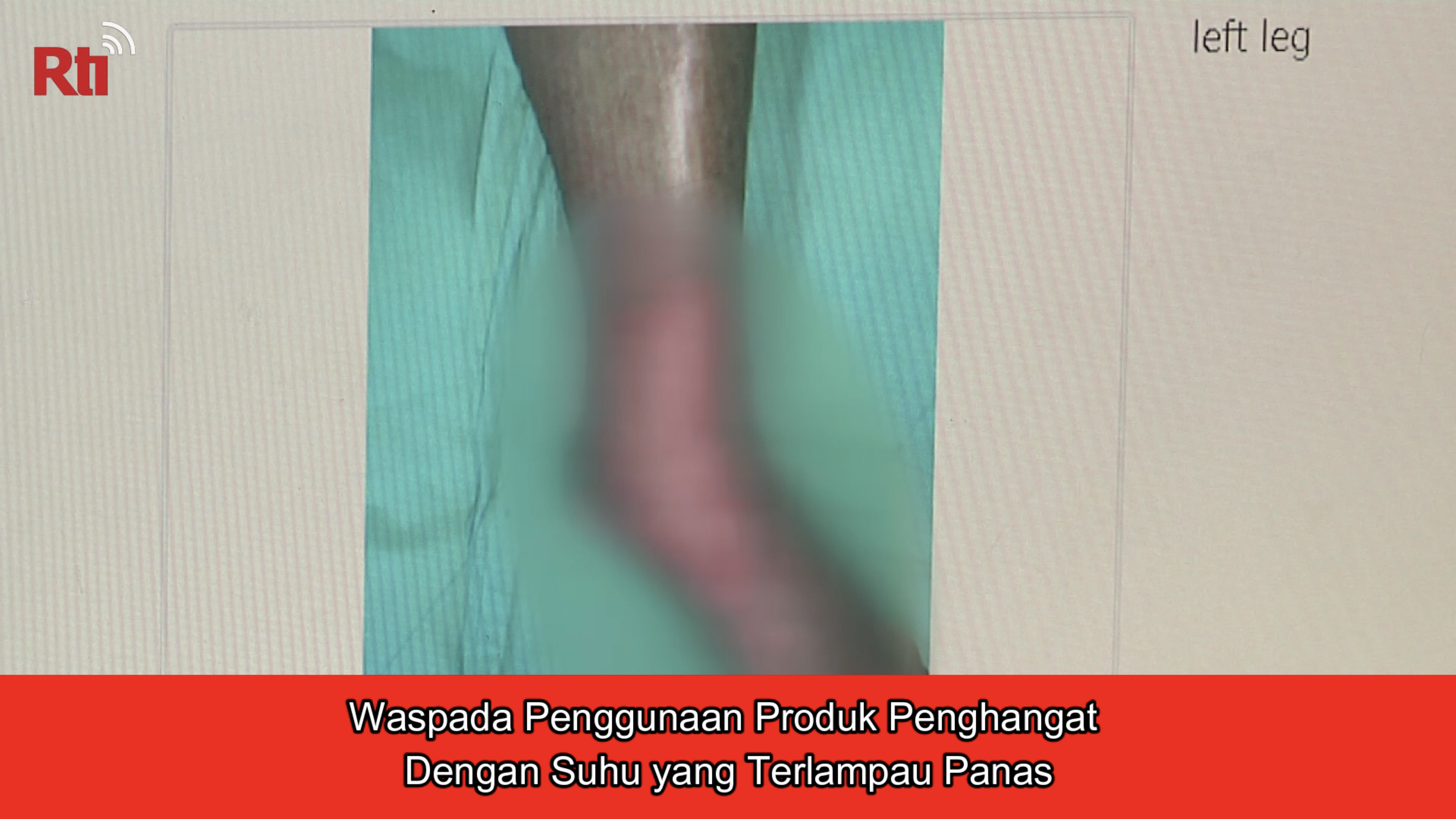 Waspada Penggunaan Produk Penghangat dengan Suhu yang Terlampau 