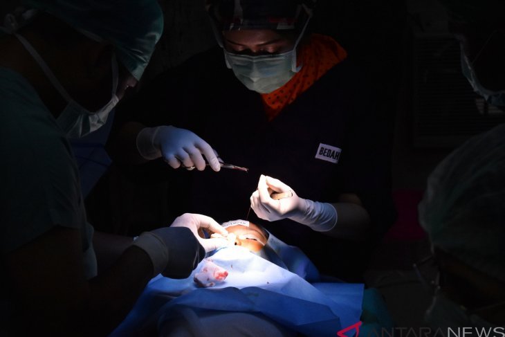 Sejumlah 27 balita berbibir sumbing jalani operasi
