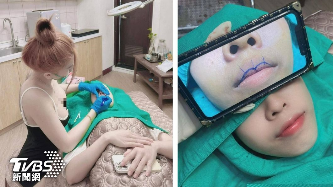 Hilang Kontak 7 Tahun! PMA Kaburan Vietnam Berubah Menjadi Dokter “Klinik Kecantikan Ilegal”, Cuan Jutaan Dolar Taiwan dari Operasi Pembesaran Payudara & Memancungkan Hidung