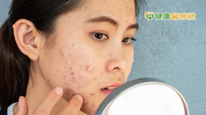 吃藥擔心副作用？療痘「心」選擇，擁有健康肌膚不是夢！ - 健康醫療網- 健康養生新聞資訊網路媒體
