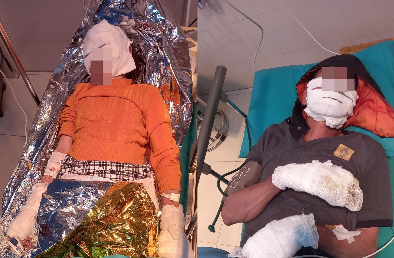 （圖／中央社）這對夫妻因手機爆炸嚴重燒傷，被緊急送醫急救。（圖／翻攝自雄王醫院臉書）