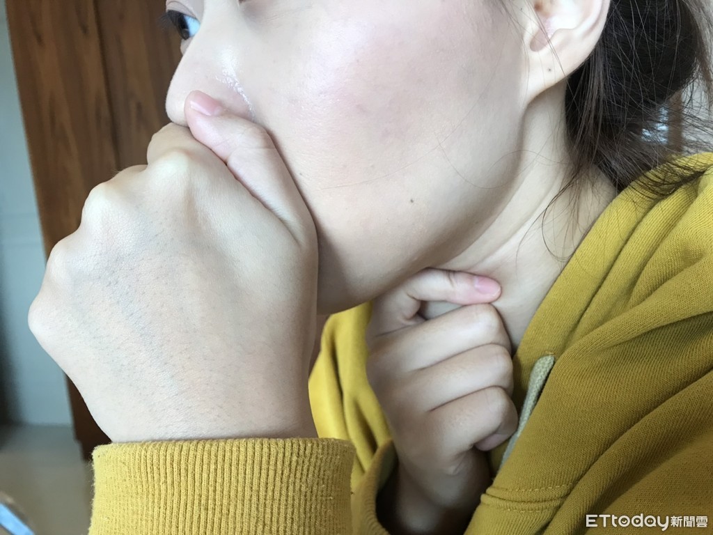 最近一堆人咳嗽！醫曝「染黴漿菌」難診斷2原因：傳染力極強| ETtoday健康雲| ETtoday新聞雲